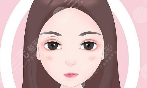 修復(fù)雙眼皮