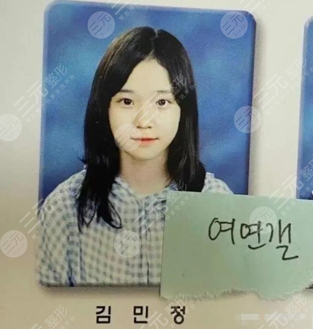 金玟庭winter陷整容風(fēng)波，她動(dòng)了哪里?