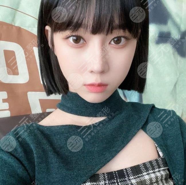 金玟庭winter陷整容風(fēng)波，她動(dòng)了哪里?