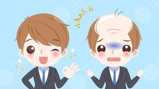 溫州大麥微針植發(fā)醫(yī)院脫發(fā)種植經歷分享