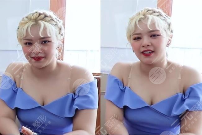 TWICE成員俞定延“發(fā)胖照”引爭議?