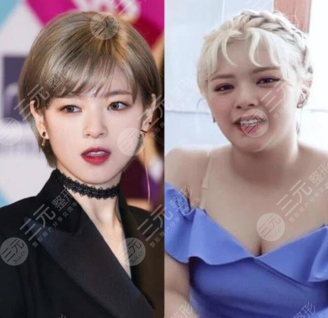 TWICE成員俞定延“發(fā)胖照”爆出！被攻擊不做身材管理顏值下降！