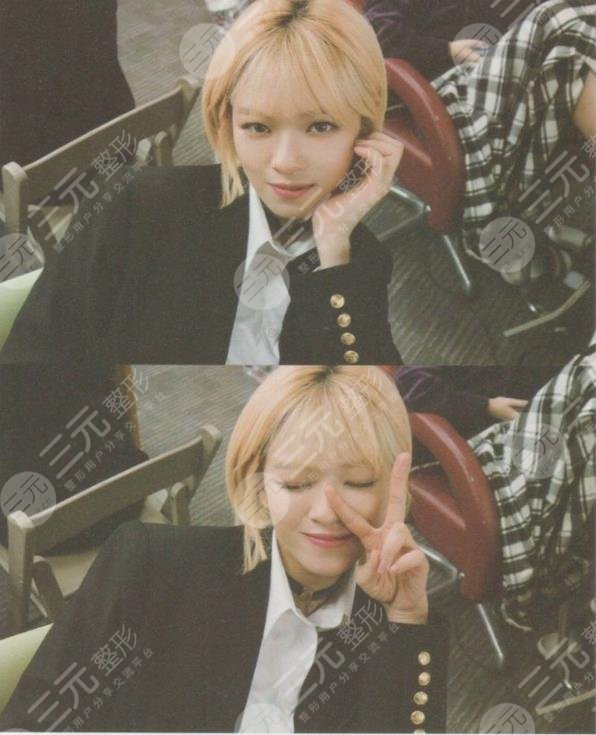 TWICE成員俞定延往后會怎么樣?