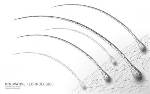 蘇州新生植發(fā)醫(yī)院大面積植發(fā)案例分享