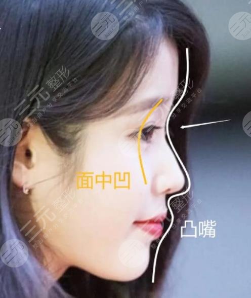IU臉上動過哪些地方?