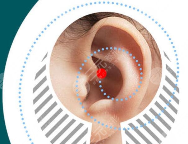 八大處楊慶華小耳畸形整形成好嗎?