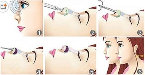 日本*醫(yī)志|精益求精，鼻部修復(fù)大師橫山才也~