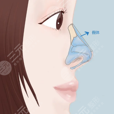 廣州韓佳人整形醫(yī)院怎么樣？?jī)r(jià)格表2021搶先一覽