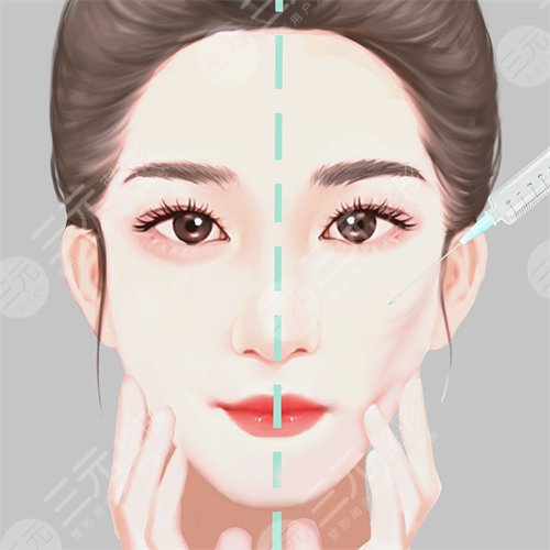 脂肪填充臉部案例分享