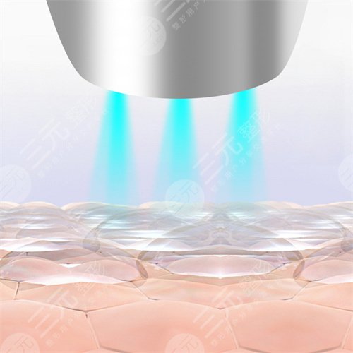 熱瑪吉相關(guān)問答科普