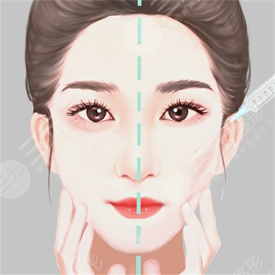 一針瘦臉瘦咬肌能維持多久