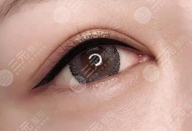 美瞳線一到七天恢復(fù)過程圖