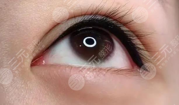 美瞳線一到七天恢復(fù)過程圖
