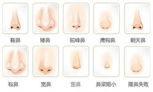 李鐘碩承認整容，韓國男神整容前后變化驚人!