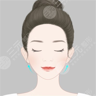 楊子珊整容前后照片