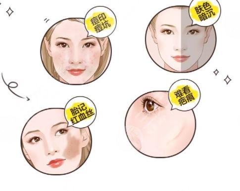 超激光美膚嫩膚