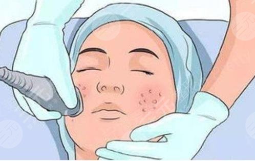 超激光美膚嫩膚