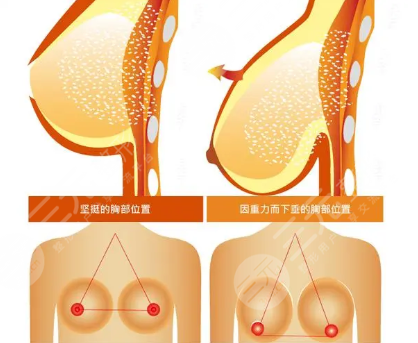 曼托隆胸的手感和真的一樣嗎