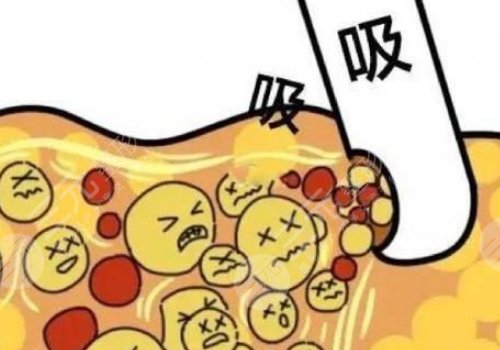 如何瘦小腿？