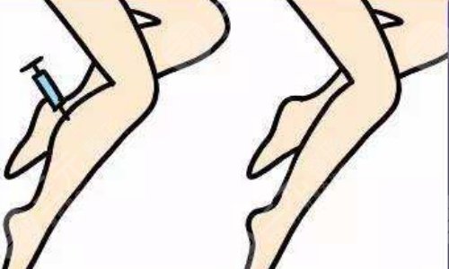 如何瘦小腿？