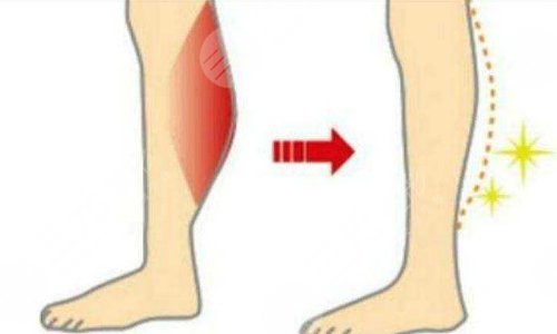 如何瘦小腿？