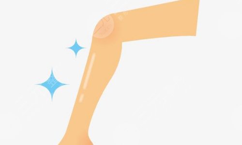 如何瘦小腿？