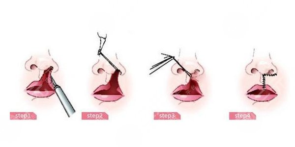 所處地區(qū)的因素：