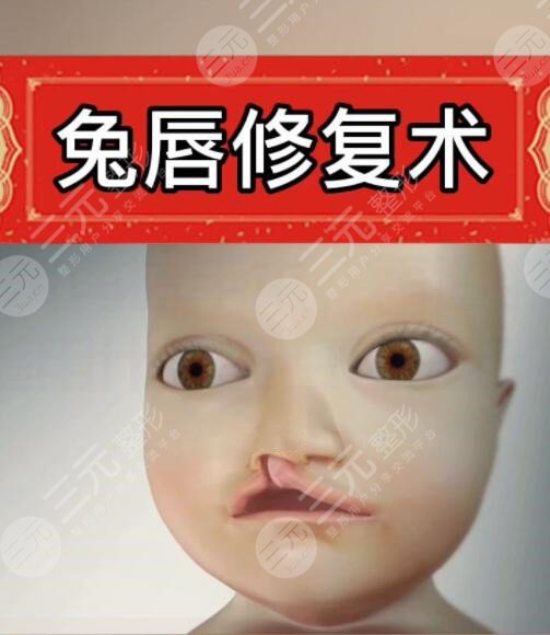 唇裂二次修復(fù)需要多少錢？?jī)r(jià)格區(qū)間+唇裂二次修復(fù)醫(yī)保能不能報(bào)銷？