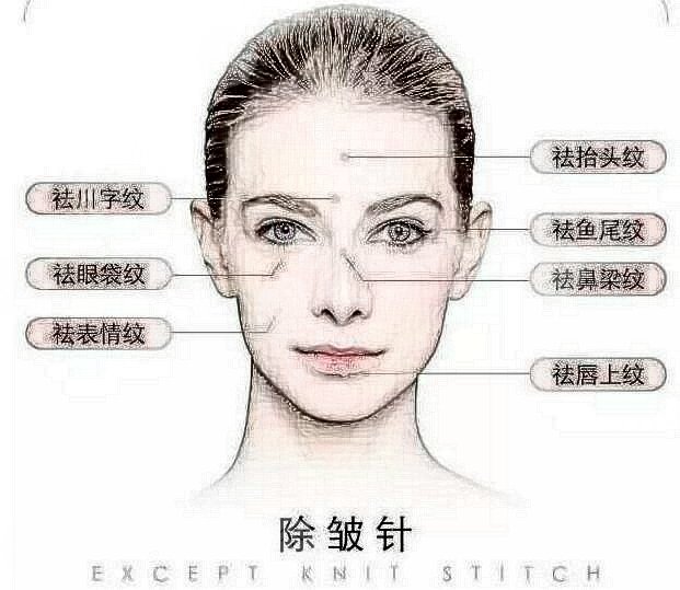 上海伯思立醫(yī)療美容除皺手術(shù)案例