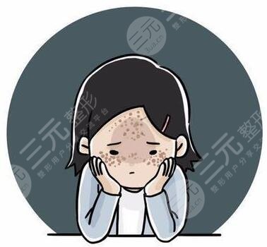 飛梭鐳射去痘坑記錄