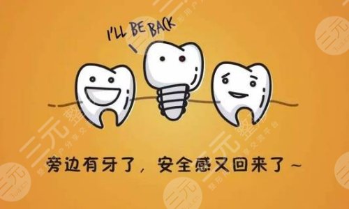 口腔問答二：種植牙過程要多久呢?