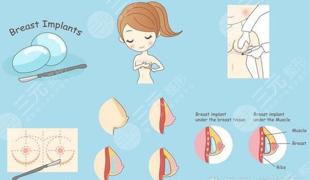 假體隆胸手術(shù)術(shù)前有哪些注意事項?