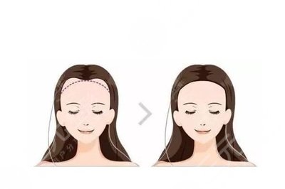 北京熙朵植發(fā)醫(yī)院特色項(xiàng)目介紹