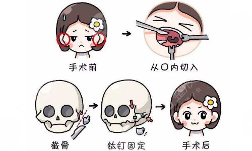 北京華韓整形醫(yī)院擅長(zhǎng)項(xiàng)目介紹