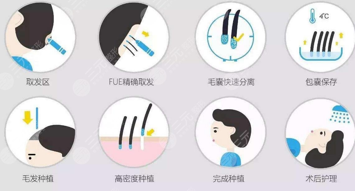 武漢協(xié)和醫(yī)院植發(fā)科開(kāi)展項(xiàng)目