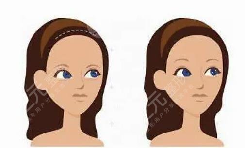 發(fā)際線(xiàn)