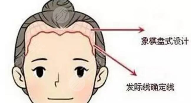 發(fā)際線(xiàn)