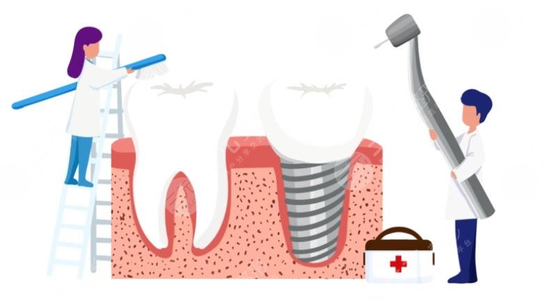 牙齒種植體十大排名NO.3、登士伯希諾德種植體