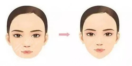 廣州荔灣醫(yī)院取出案例反饋