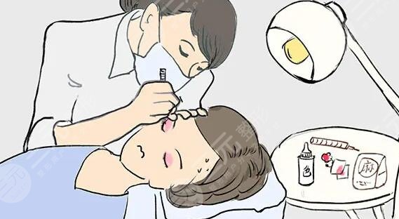 美瞳線一到七天恢復(fù)圖，網(wǎng)友：別太急著跟潮流，多了解清楚對你有好處！