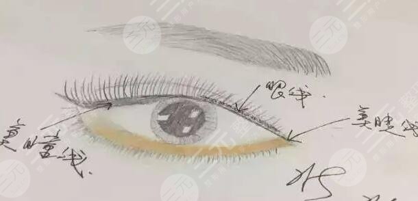 美瞳線手術(shù)術(shù)前