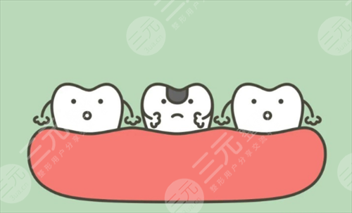 牙髓炎根管緩解費(fèi)用