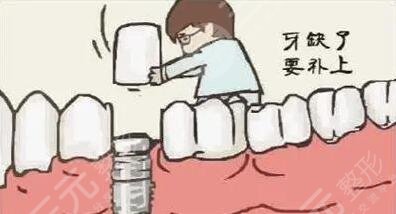 種植牙項(xiàng)目注意事項(xiàng)