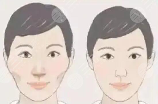 磨骨手術(shù)對(duì)醫(yī)院的要求