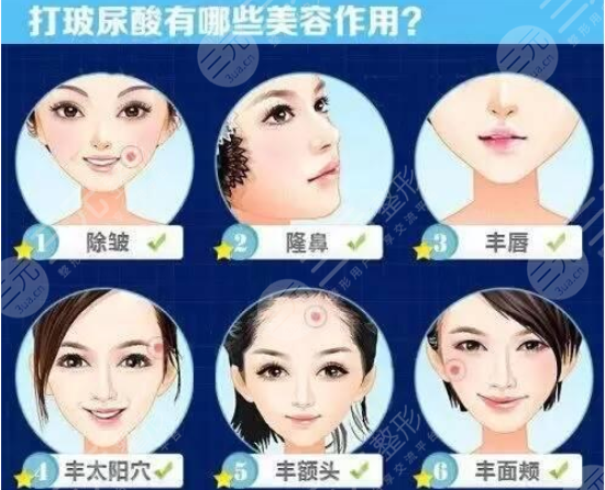 玻尿酸的作用,玻尿酸功