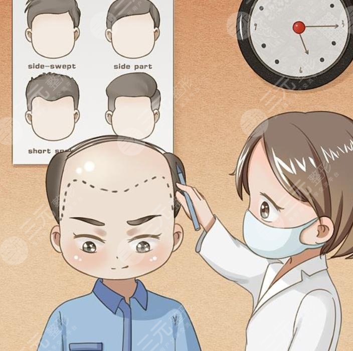 山大一院植發(fā)案例