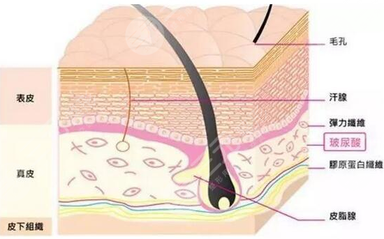 美白祛斑和玻尿酸填充哪個(gè)好？2者應(yīng)該怎么選？注意事項(xiàng)有哪些呢？