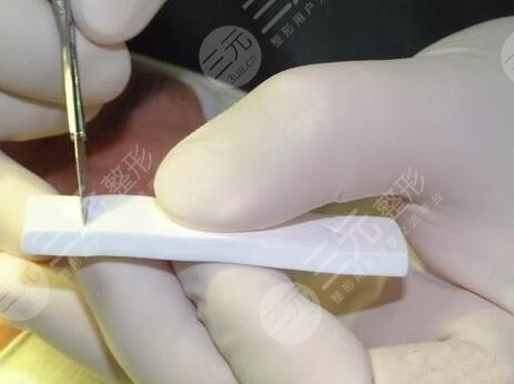 女子隆鼻手術(shù)后心臟驟停