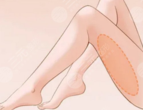 ****注射瘦腿降低風(fēng)險嗎