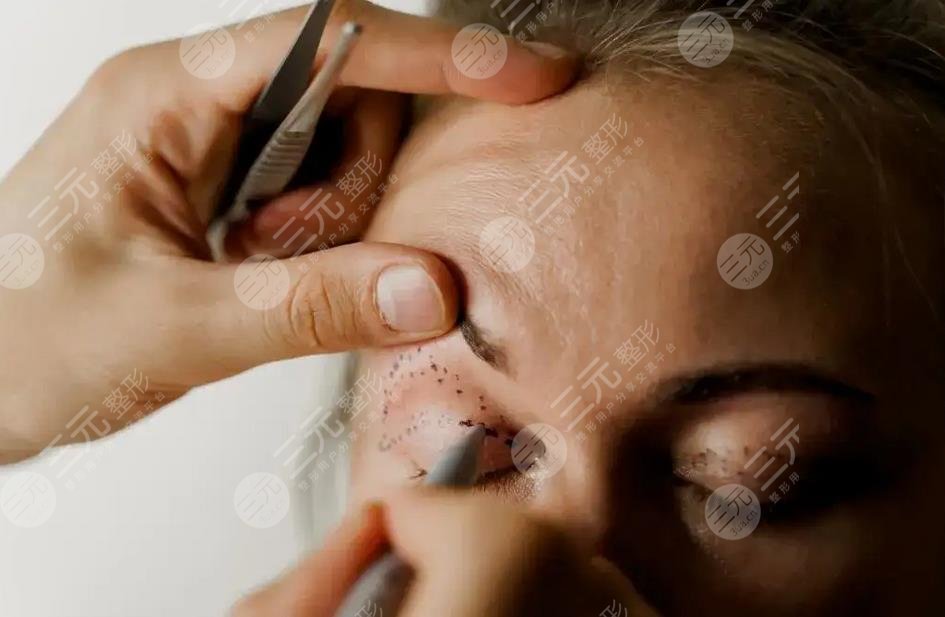 女子整容整出九級傷殘是真的嗎?